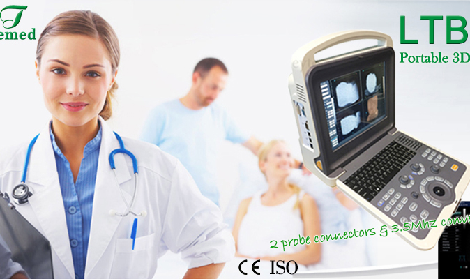 2017 Hot sale portable color ultrasound scanner