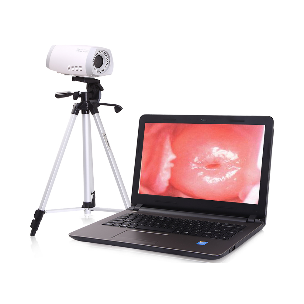 LTEC02 CE portable colposcope