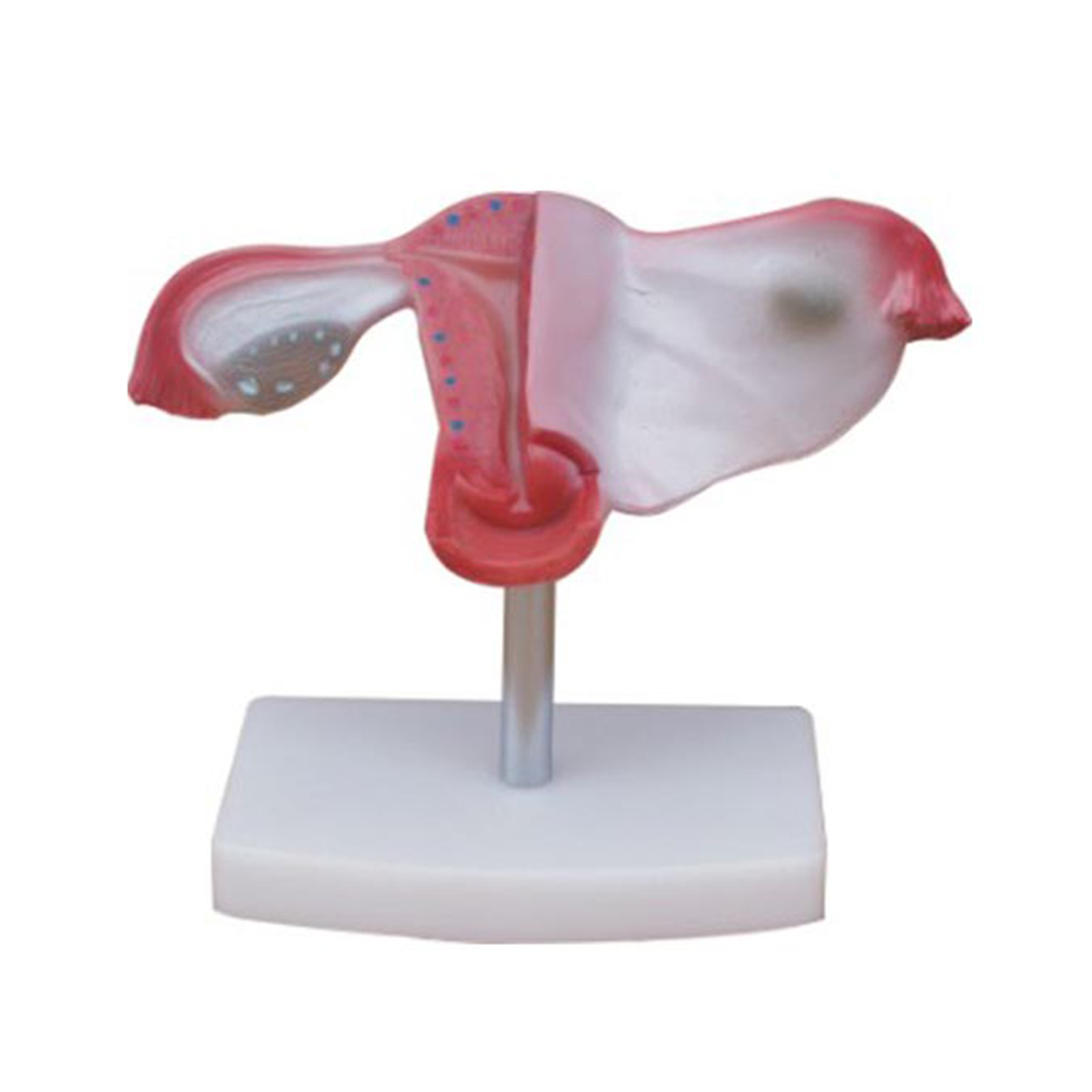 LTM421A Natural Uterus Model