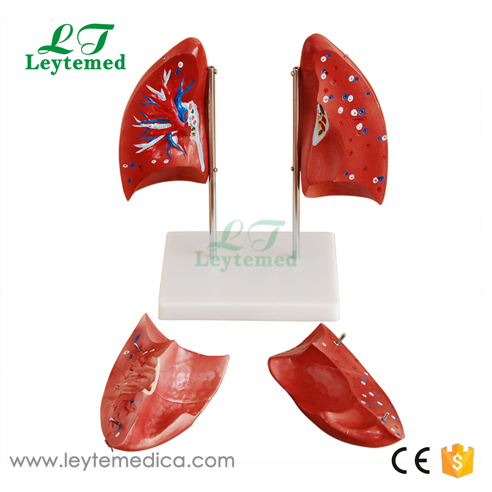 LTM321 Lung Model