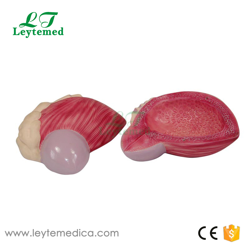 LTM317 Expansion Model of Urinary Bladder