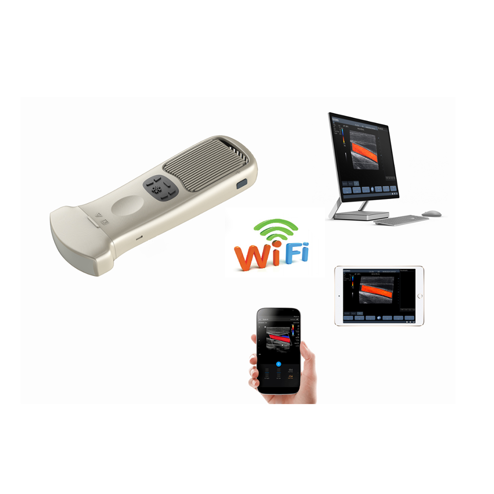 LTUB31 Wireless Color Doppler Ultrasound Diagnostic System