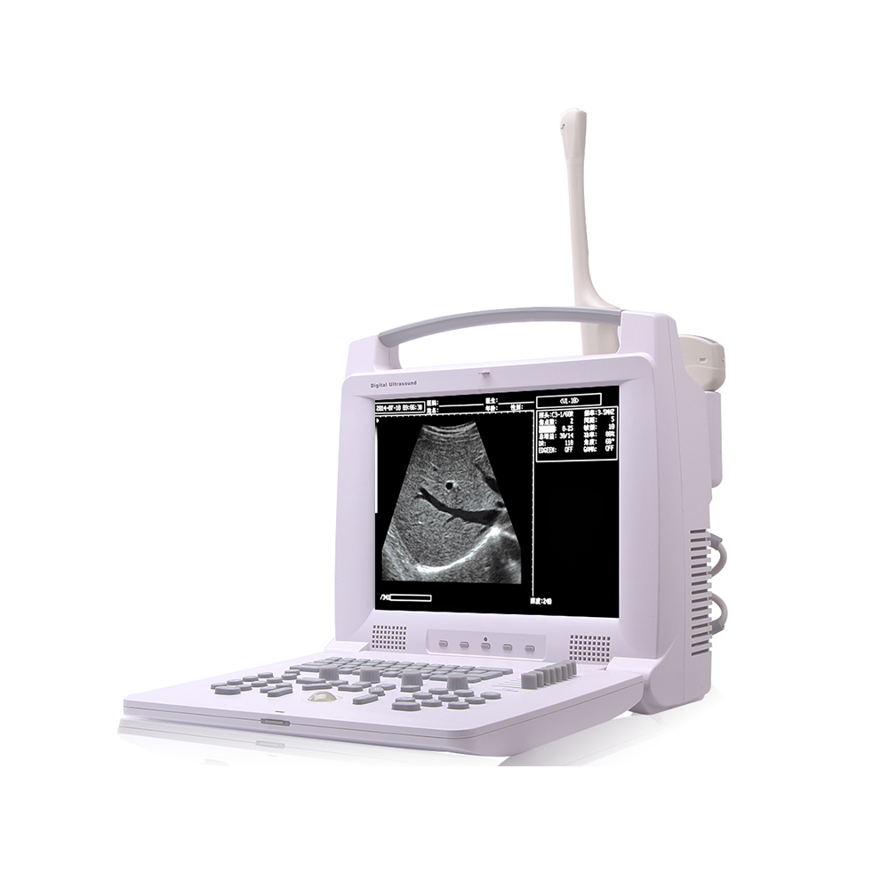 LTUB29 portable cheapest portable ultrasound USG machine for sale