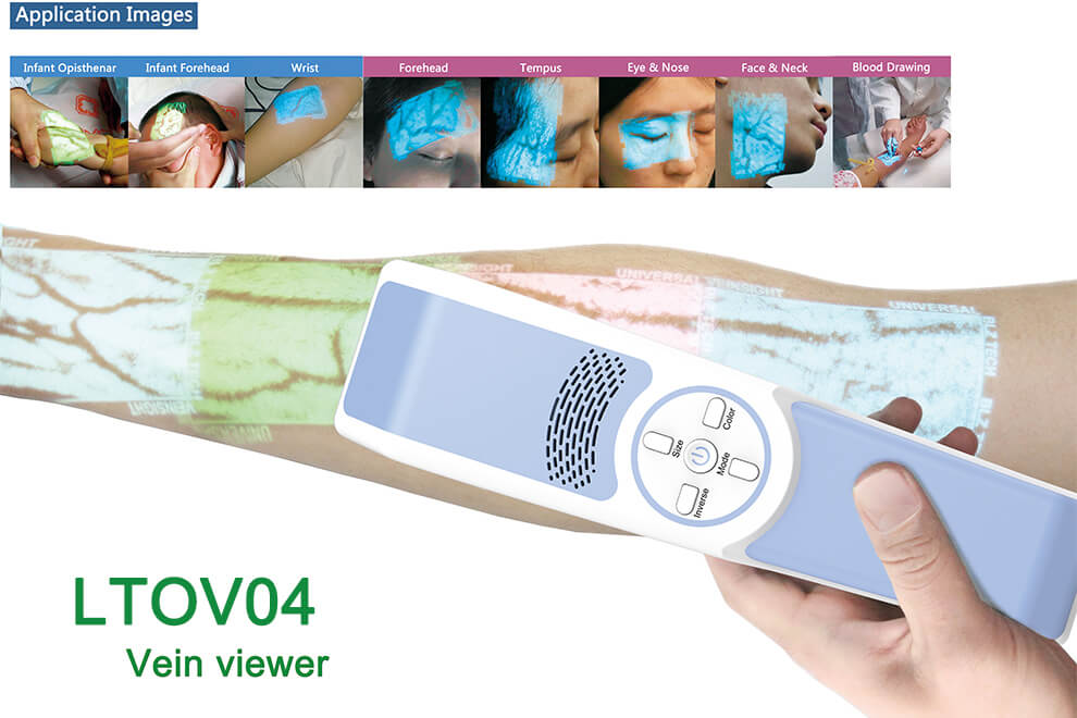 How it does work? & FAQ -- LTOV04 vein viewer Shining the Light on Veins